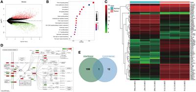 CircNRIP1 Encapsulated by Bone Marrow Mesenchymal Stem Cell–Derived Extracellular Vesicles Aggravates Osteosarcoma by Modulating the miR-532-3p/AKT3/PI3K/AKT Axis